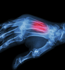 Complex Repair Of Acute And Chronic Hand And Elbow Injuries